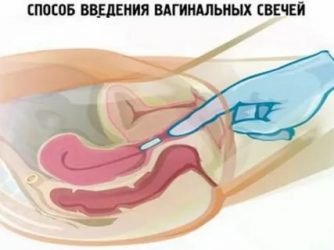 Что делать чтобы свечи не вытекали?